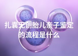 扎囊无创胎儿亲子鉴定的流程是什么