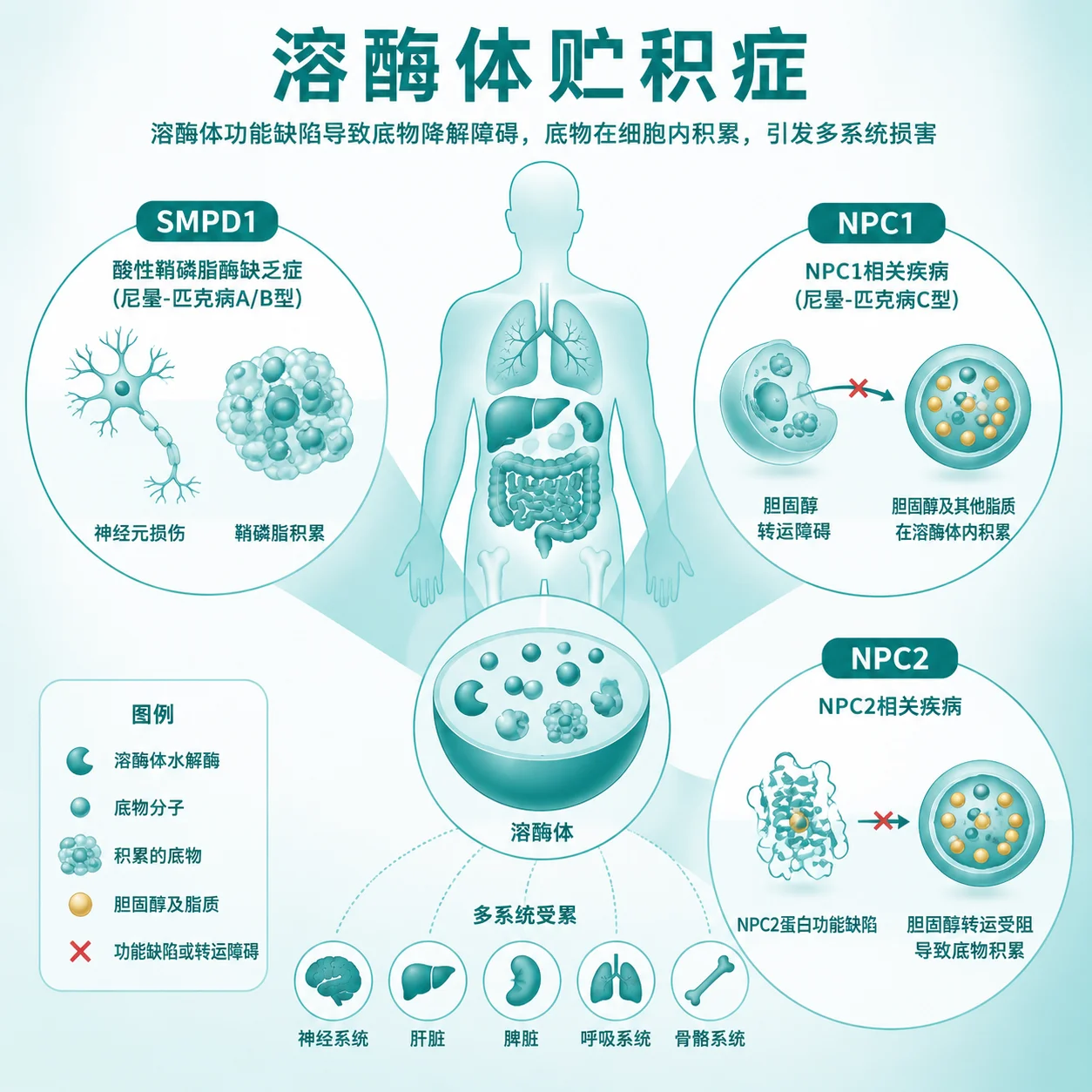 尼曼- 匹克病 - 溶酶体贮积症示意图