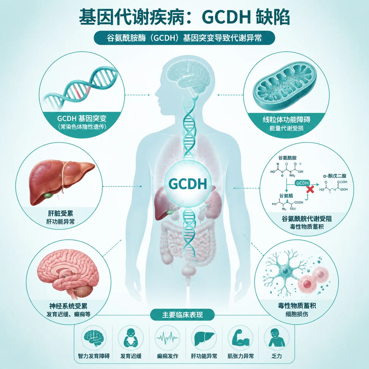 戊二酸血症 - 遗传代谢病示意