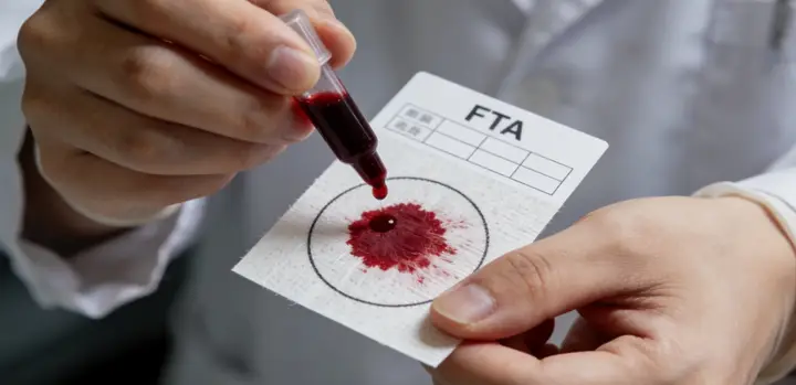 阜康亲子鉴定采样