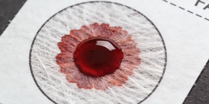 丹棱亲子鉴定采样过程