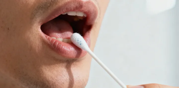 郯城亲子鉴定采样过程