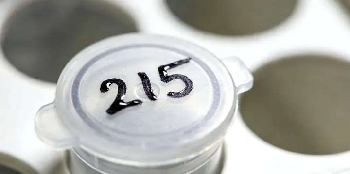 上虞亲子鉴定采样现场