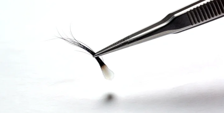 双江亲子鉴定样本采集