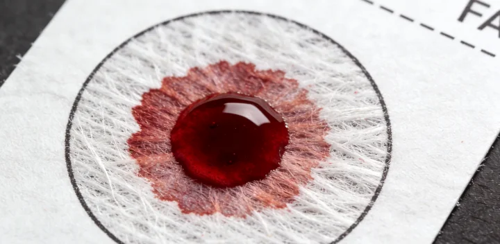 濮阳华龙亲子鉴定样本采集