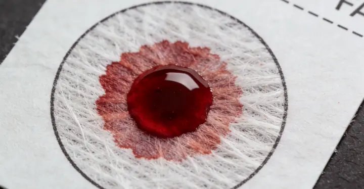 大箐山亲子鉴定抽血