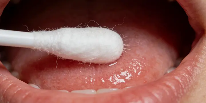 德保亲子鉴定样本采集