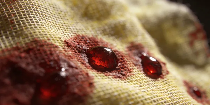 乌拉特前旗亲子鉴定材料