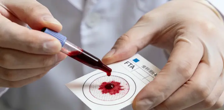 西双版纳亲子鉴定样本采集