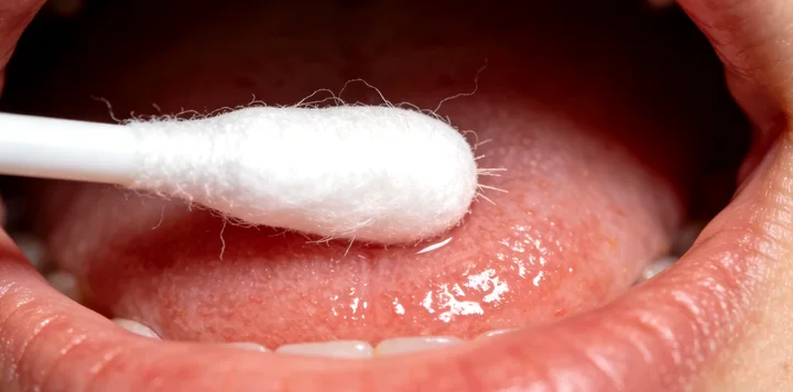 抚远亲子鉴定口腔采样