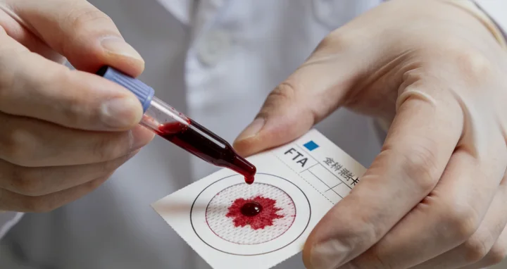 大同新荣司法亲子鉴定采样