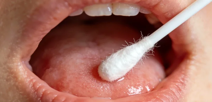 和林格尔亲子鉴定采样