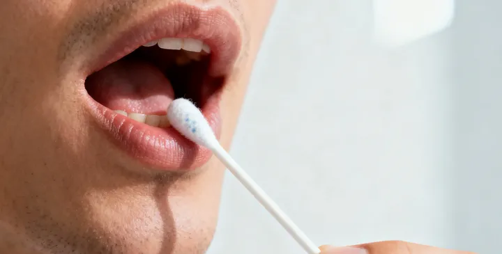 精河亲子鉴定口腔拭子采样 精河亲子鉴定口腔拭子采样