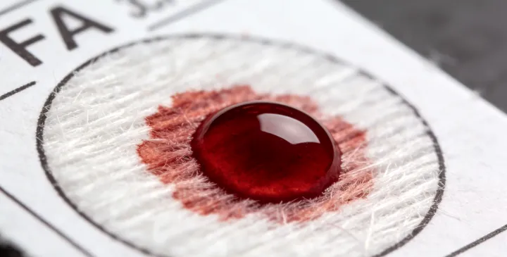 长春亲子鉴定采样 长春亲子鉴定采样