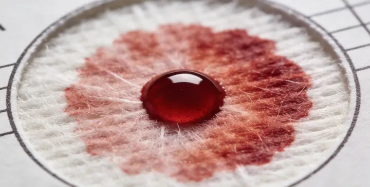 临朐亲子鉴定采样 临朐亲子鉴定采样