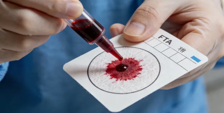 连山亲子鉴定采样现场 连山亲子鉴定采样现场