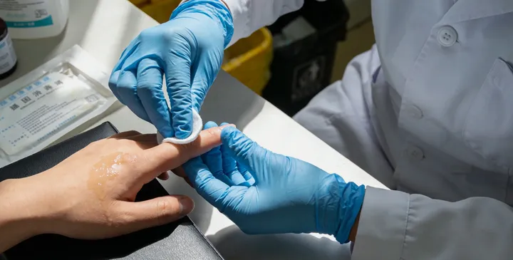 桂阳亲子鉴定采样过程 桂阳亲子鉴定采样过程