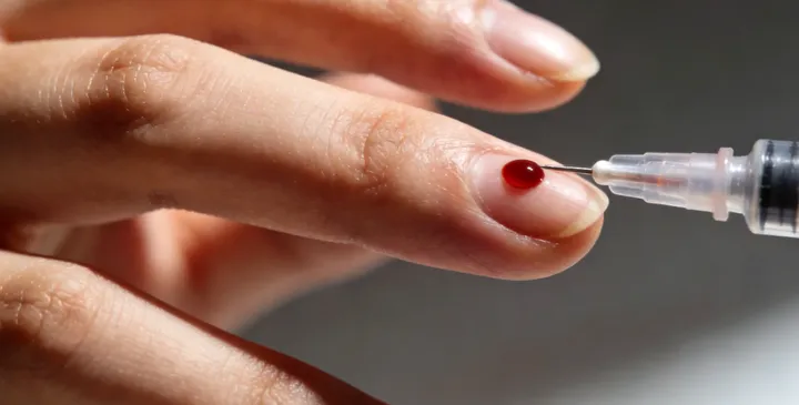 马边亲子鉴定采样现场 马边亲子鉴定采样现场