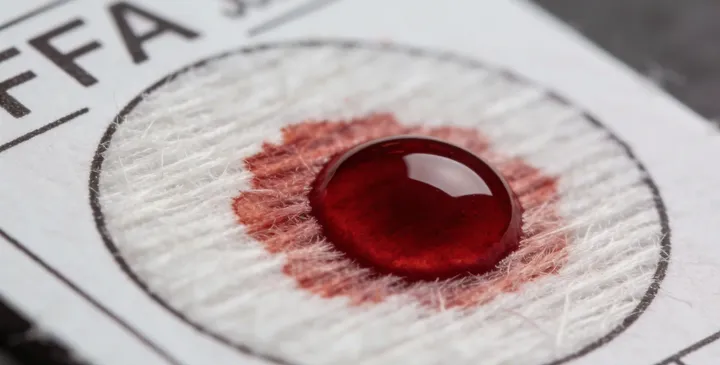 于田亲子鉴定采样现场 于田亲子鉴定采样现场