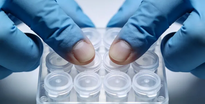 阜南亲子鉴定采样过程 阜南亲子鉴定采样过程