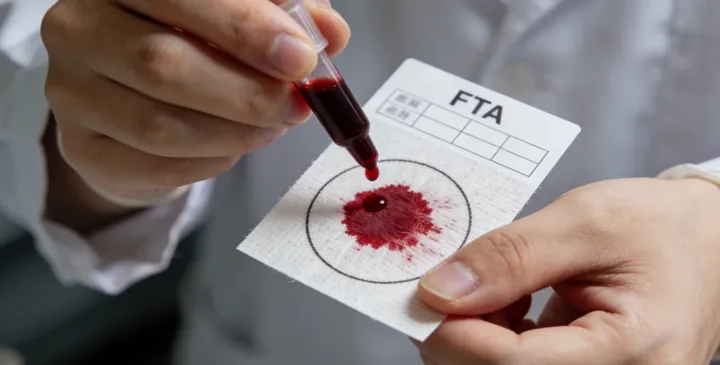 宿松亲子鉴定采样现场 宿松亲子鉴定采样现场