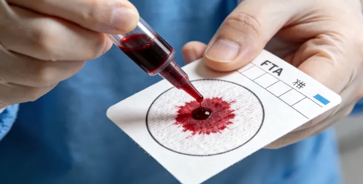 廊坊广阳亲子鉴定采样 廊坊广阳亲子鉴定采样