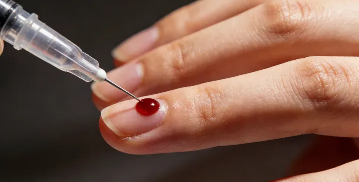 阿克陶亲子鉴定采样现场 阿克陶亲子鉴定采样现场