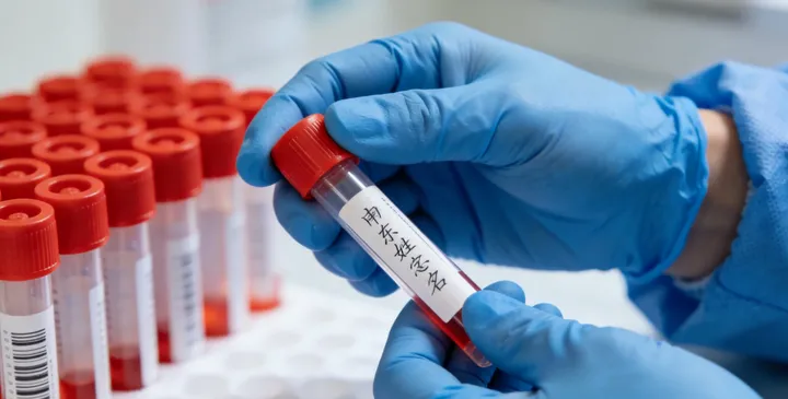 伊春伊美亲子鉴定采样过程 伊春伊美亲子鉴定采样过程