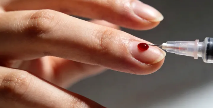 大庆大同司法亲子鉴定采样 大庆大同司法亲子鉴定采样