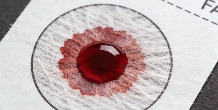 围场亲子鉴定采样过程 围场亲子鉴定采样过程