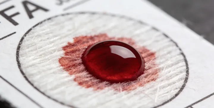 浦江亲子鉴定采样 浦江亲子鉴定采样