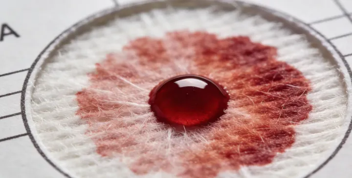 夏邑亲子鉴定样本采集 夏邑亲子鉴定样本采集