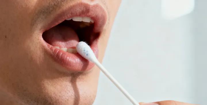 银川亲子鉴定采样过程 银川亲子鉴定采样过程