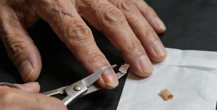 丹东亲子鉴定采样现场 丹东亲子鉴定采样现场