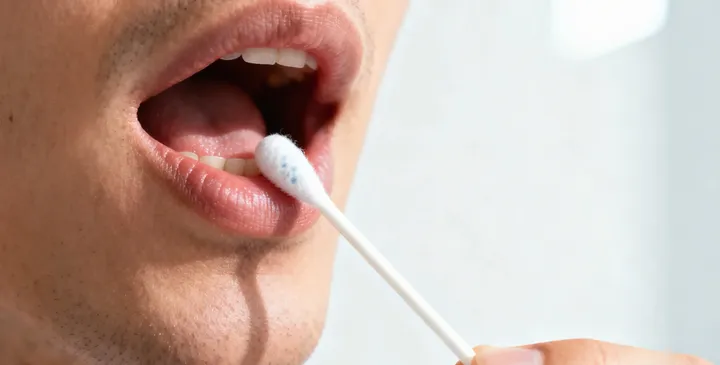 营山DNA采样过程 营山DNA采样过程