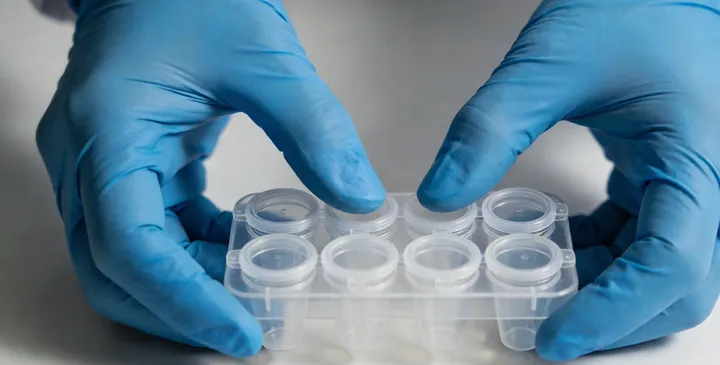 庐阳亲子鉴定采样现场 庐阳亲子鉴定采样现场