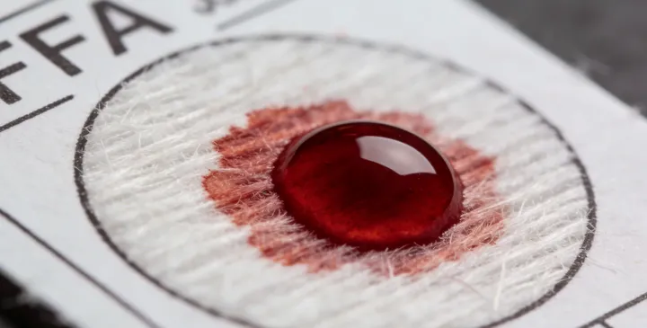 涞水亲子鉴定采样过程 涞水亲子鉴定采样过程