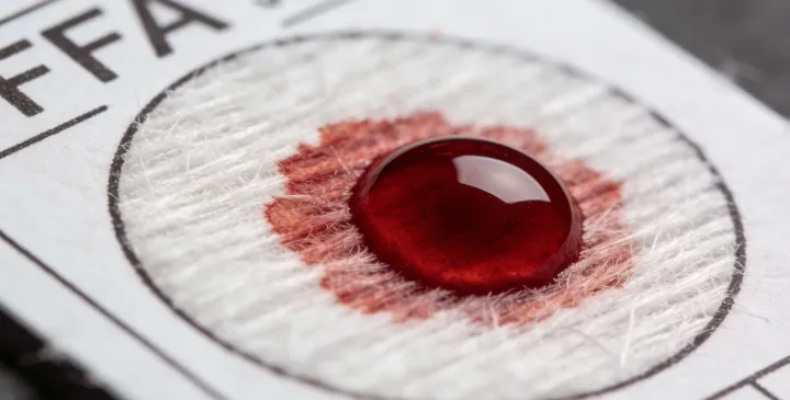 剑川亲子鉴定采样过程 剑川亲子鉴定采样过程