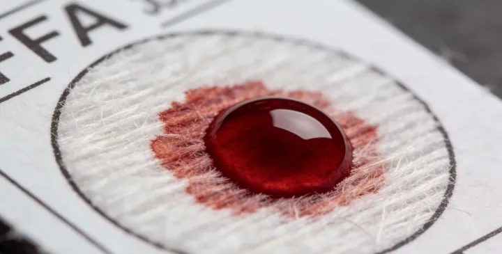 锦州古塔亲子鉴定采样过程 锦州古塔亲子鉴定采样过程