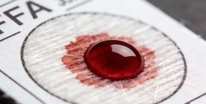 岳普湖亲子鉴定采样现场 岳普湖亲子鉴定采样现场