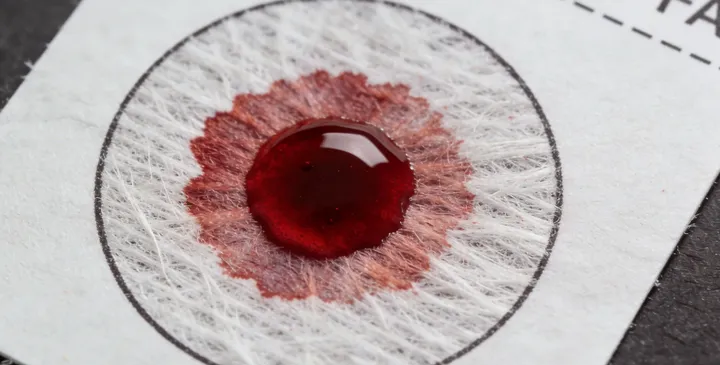 成都温江亲子鉴定采样过程 成都温江亲子鉴定采样过程