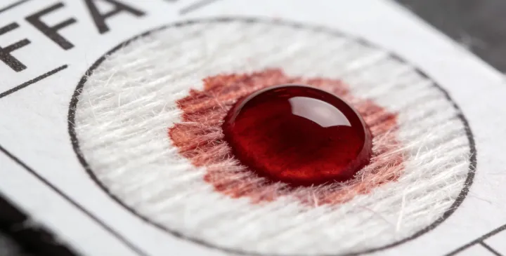 西宁亲子鉴定采样 西宁亲子鉴定采样