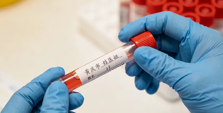 龙山无创亲子鉴定采样 龙山无创亲子鉴定采样