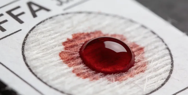 桓仁亲子鉴定采样过程 桓仁亲子鉴定采样过程