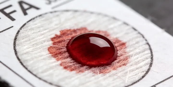 古蔺亲子鉴定样本采集 古蔺亲子鉴定样本采集