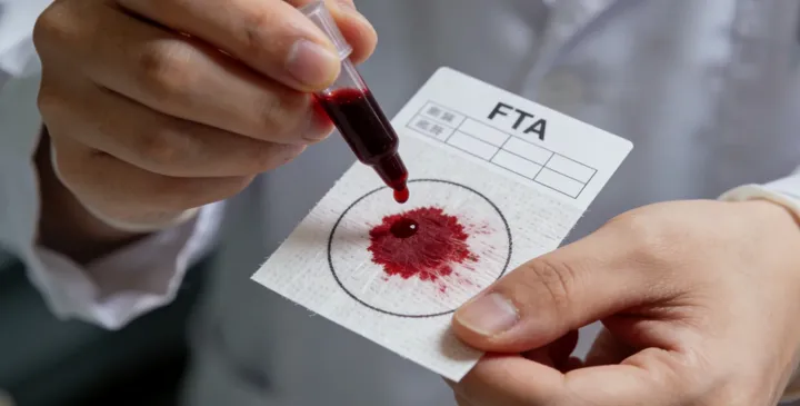 德兴DNA采样操作 德兴DNA采样操作