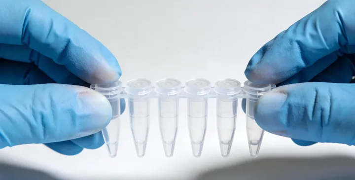 德兴静脉血亲子鉴定抽血过程 德兴静脉血亲子鉴定抽血过程