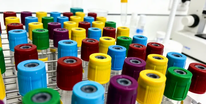 上饶信州亲子鉴定采样现场 上饶信州亲子鉴定采样现场