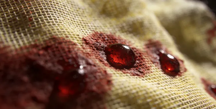 昭苏亲子鉴定采样 昭苏亲子鉴定采样