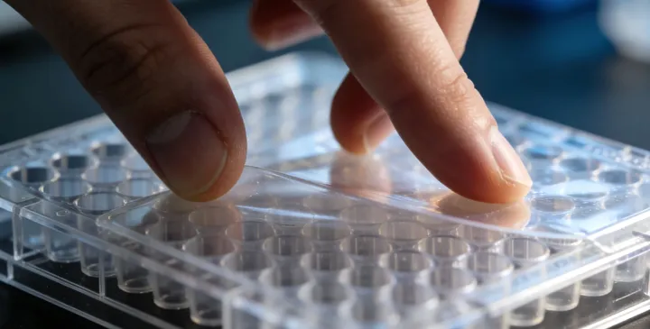 尼勒克无创胎儿亲子鉴定采样过程 尼勒克无创胎儿亲子鉴定采样过程